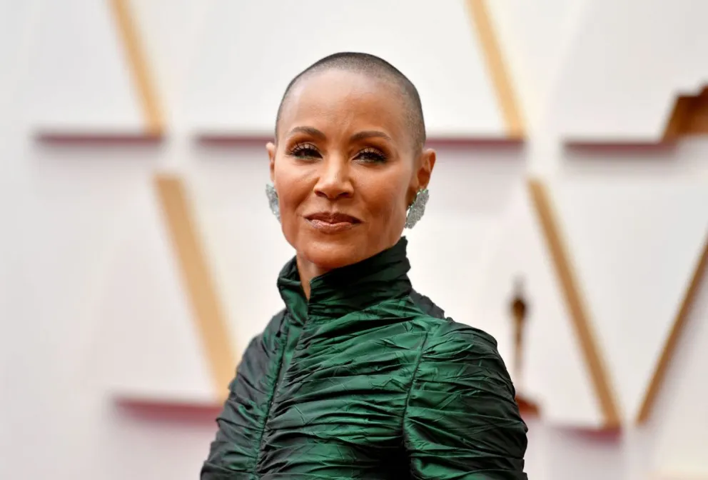Alopecia: así es la enfermedad que sufre Jada Pinkett Smith