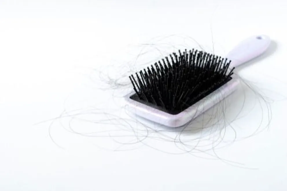 La sociedad pone etiquetas a personas con alopecia