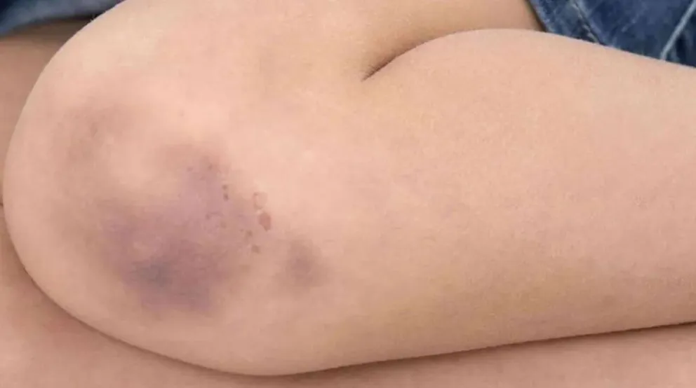 San Juan: una mujer golpeó a su hija con una tabla por no saber las letras