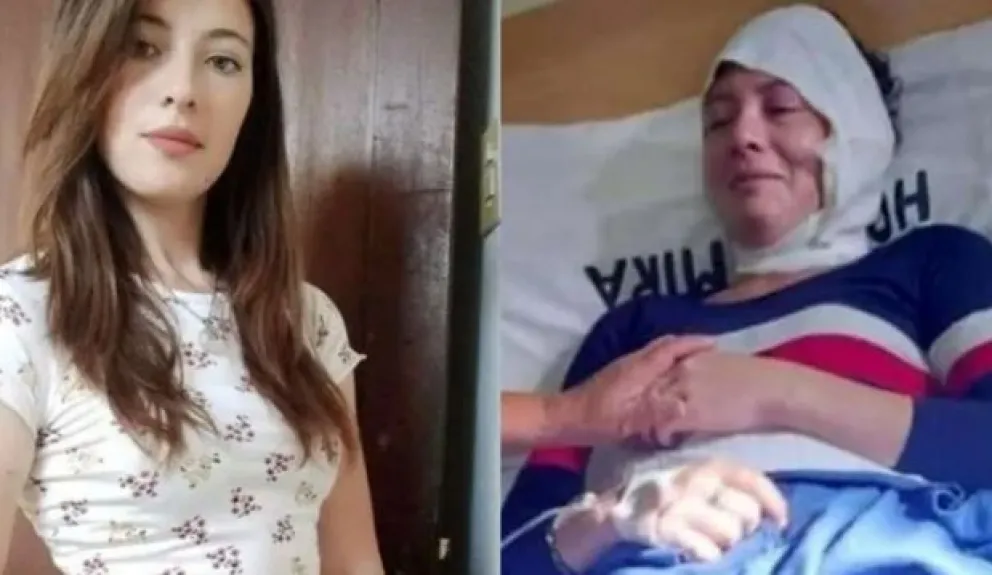 Un hombre citó a su ex pareja por la cuota alimentaria de su hijo y la quemó con aceite hirviendo