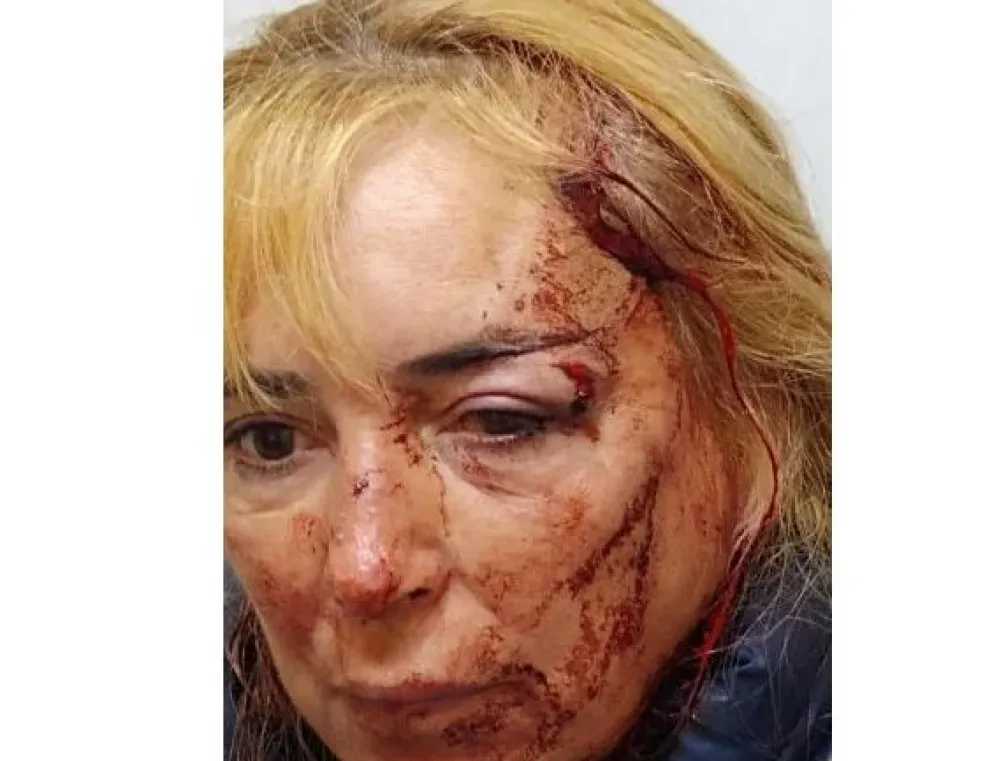 Insólito: el dueño de un bar le dio una brutal golpiza a una pareja porque no pagaron una bebida 