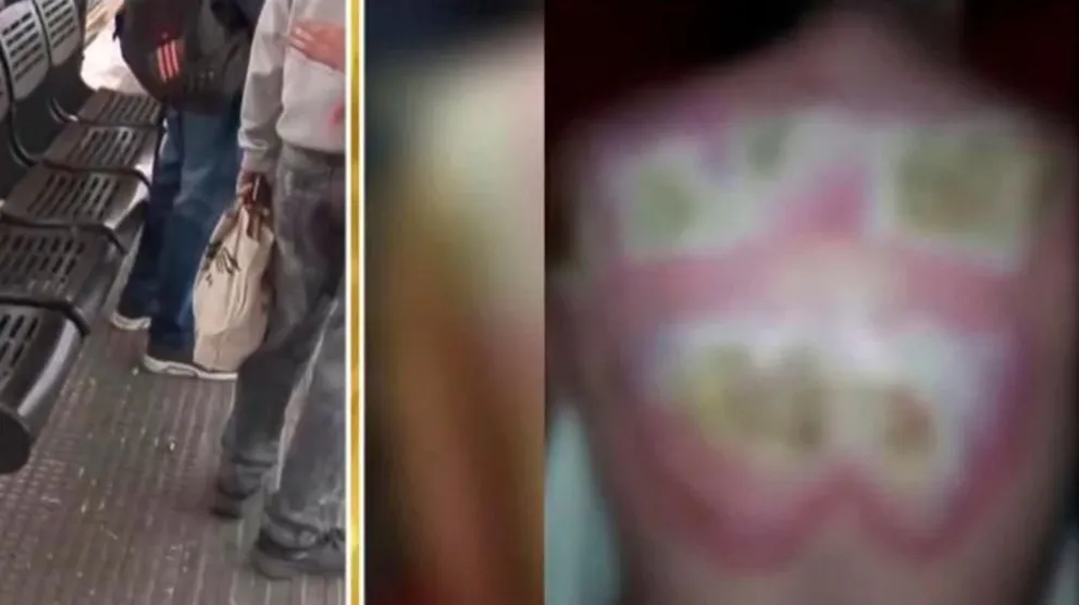 Impactantes imágenes: le tiraron ácido para robarle el bolso en la parada del colectivo 
